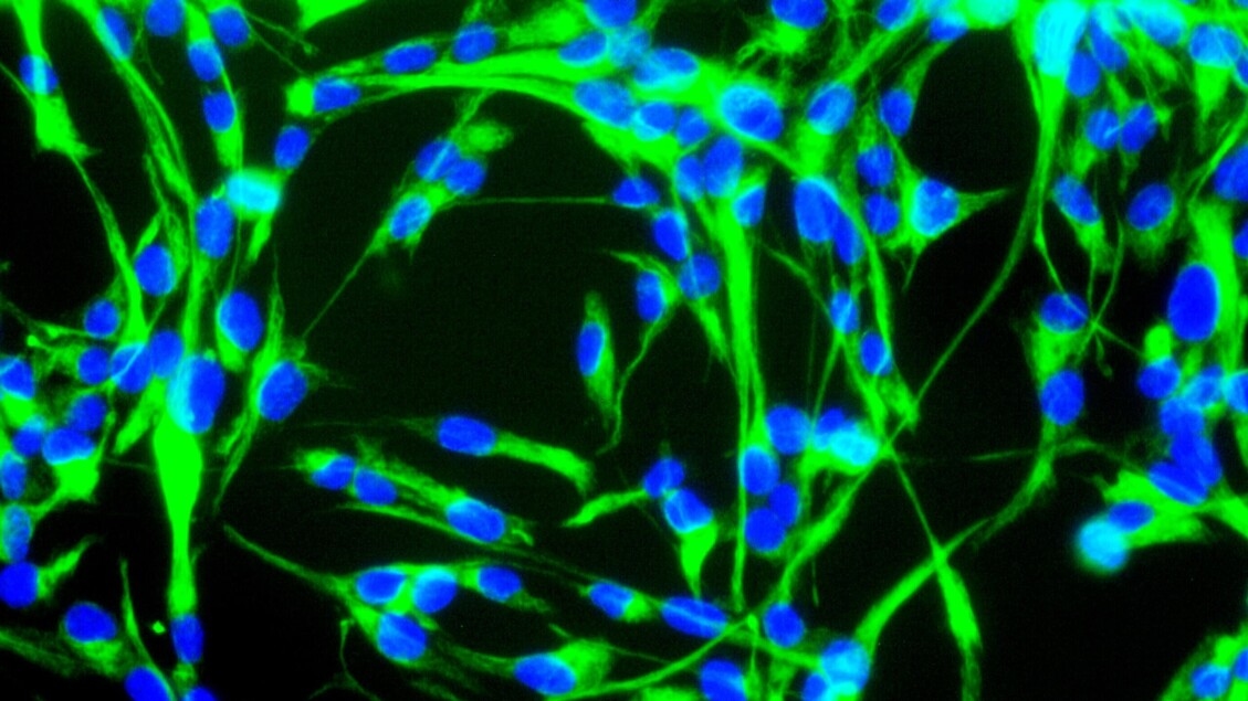 Stem cell transplantation works in mice to treat stroke