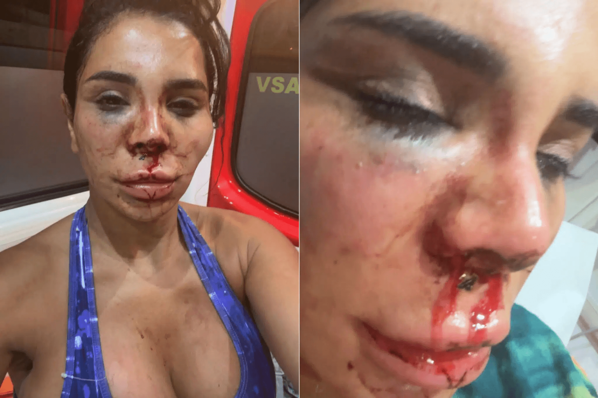 Influencer Soraya, víctima de secuestro violento: cúteres, ácido, violencia física, ataduras...