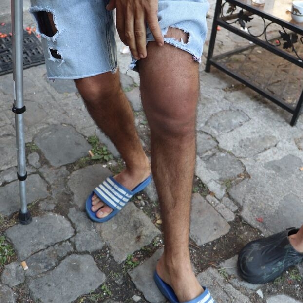 Montreuil (93): Bir "kira anlaşmazlığı" zemininde, iki adam bir evin sahibi ve yaklaşık otuz suç ortağı tarafından kör nesnelerle vahşice saldırıya uğradı