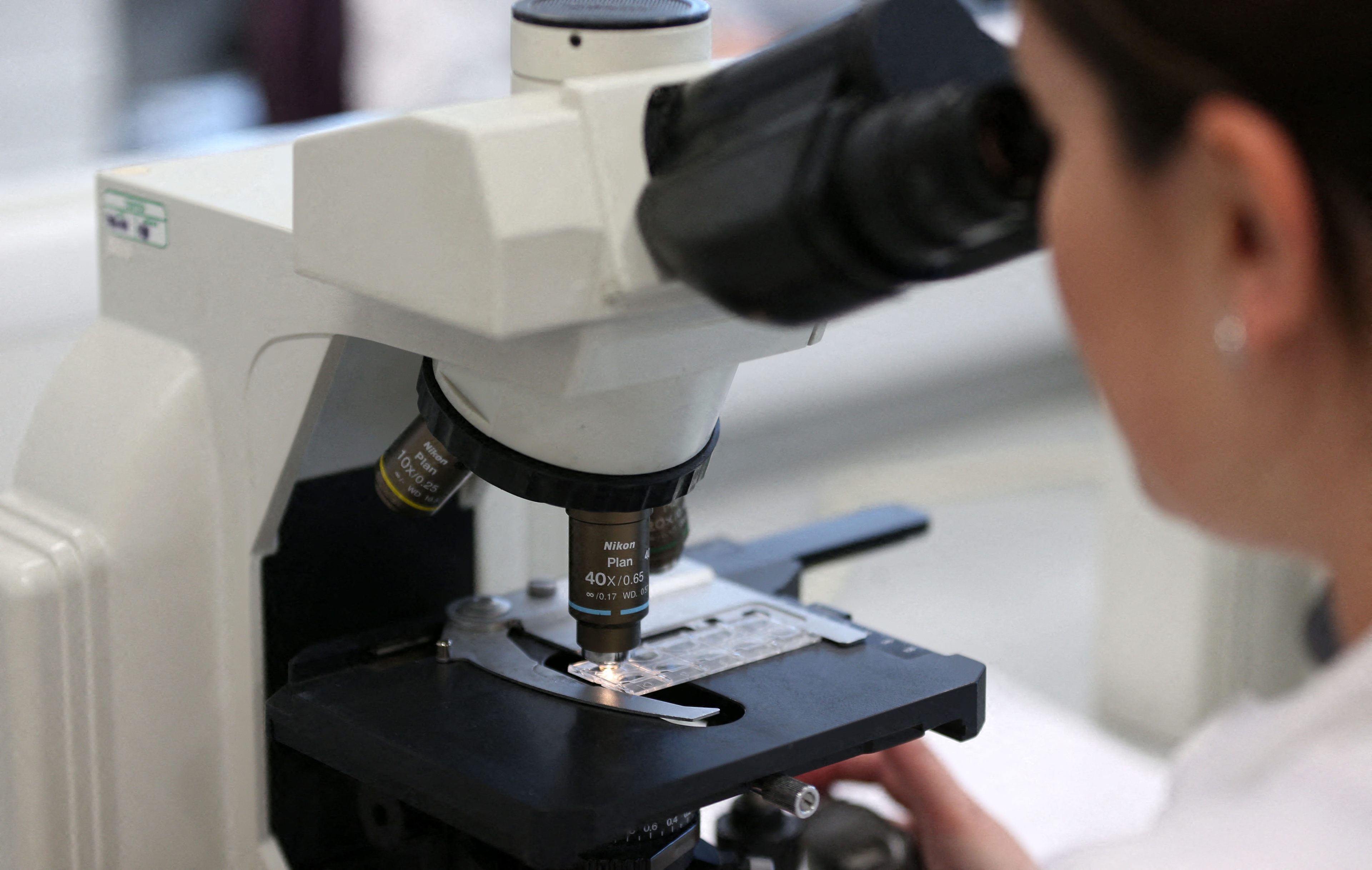 Baby saved by rewriting a letter of his DNA