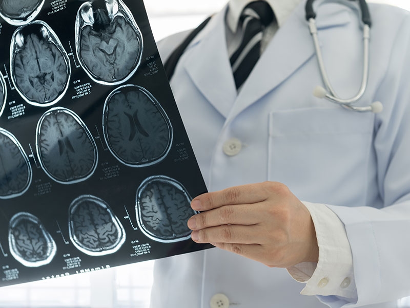 Neurologie: Wie natürliche Intelligenz immer noch die künstliche Intelligenz schlägt
