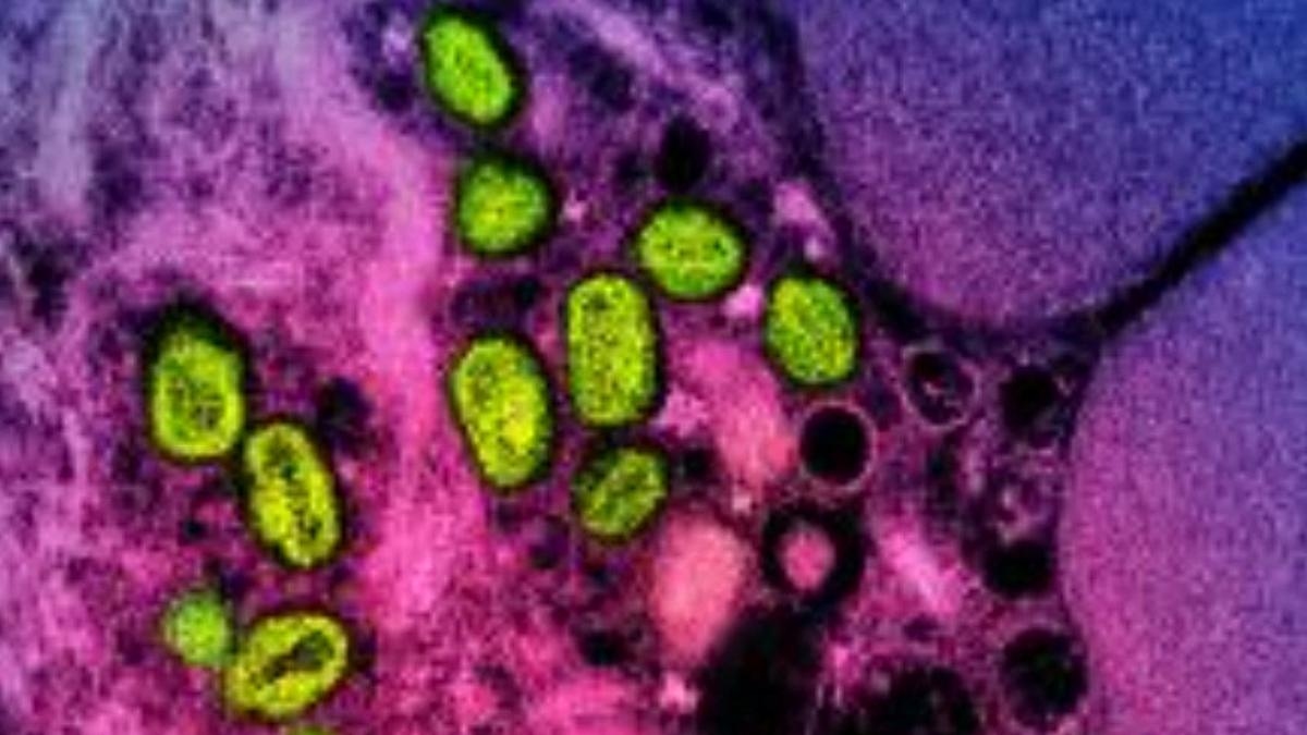 В Испании зарегистрирован первый случай смерти от MPOX (оспы обезьян) с 2022 года.