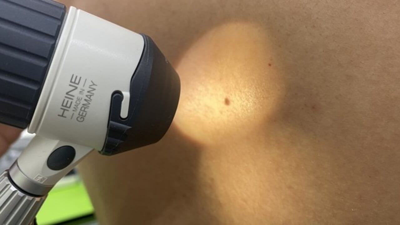 Consultations dermatologiques gratuites pour ses salariés : l'initiative de l'entreprise Alta