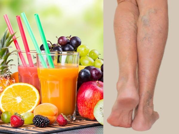 De drie sappen die je van spataderen verlossen: ze zijn heerlijk en verfrissend
