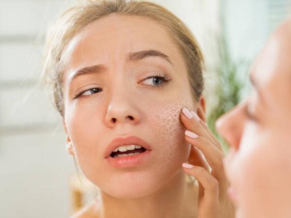 Flaky skin and dry eyes: a lack of this vitamin can ruin your body