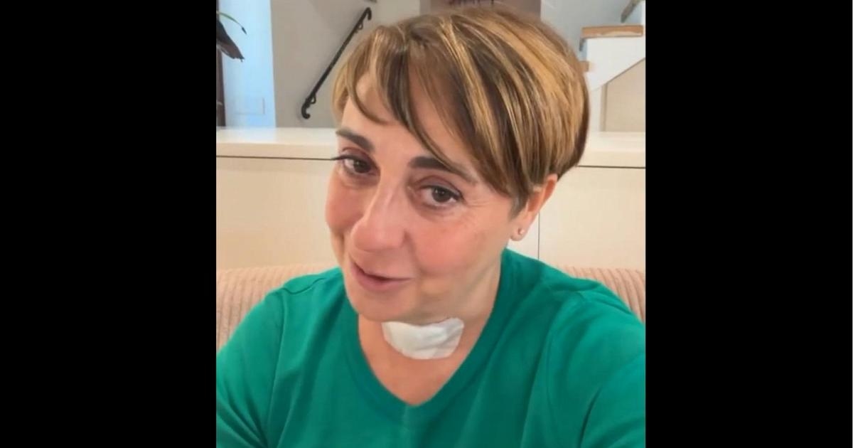 Tiroid ameliyatı sonrası Benedetta Rossi: "Sesim hâlâ kısık ama her geçen gün daha iyiye gidiyorum."