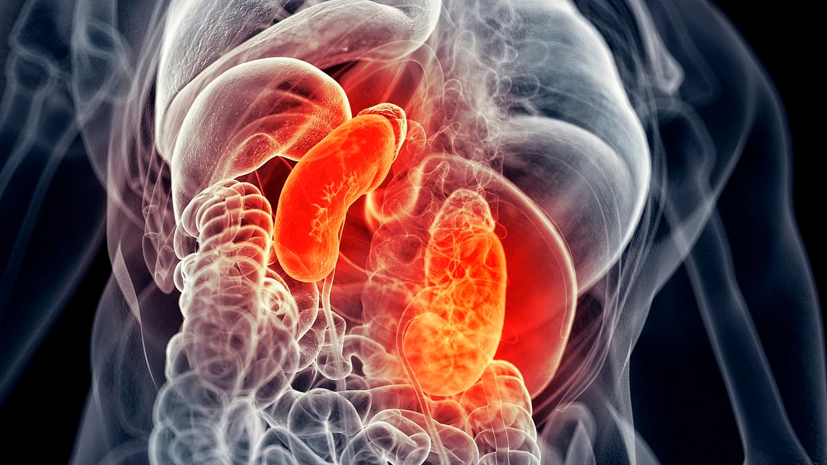 A doença renal crônica mais que dobrou desde 1990, chegando a 800 milhões de pessoas, segundo especialistas: "É uma crescente crise global de saúde".