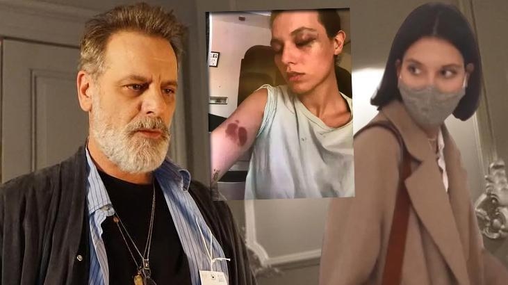 La sua condanna a 45 giorni è stata confermata! La prima dichiarazione di Ozan Güven in 5 anni