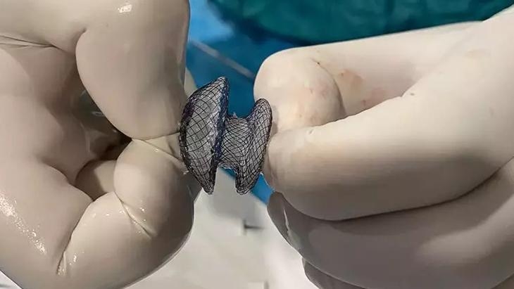 Een gat in het hart is niet langer eng: behandeling in 15 minuten met een moderne gesloten methode