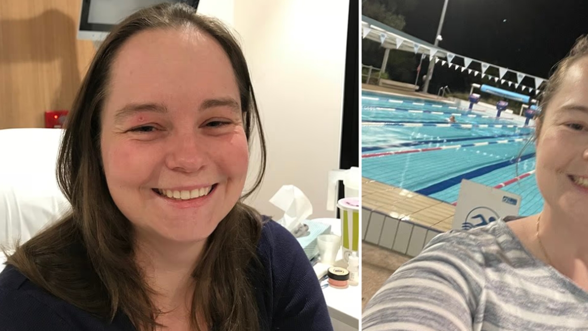 Mujer de 26 años comenzó a tener náuseas, rasquiña y moretones sin explicación: le diagnosticaron una rara enfermedad que podía resultar en cáncer