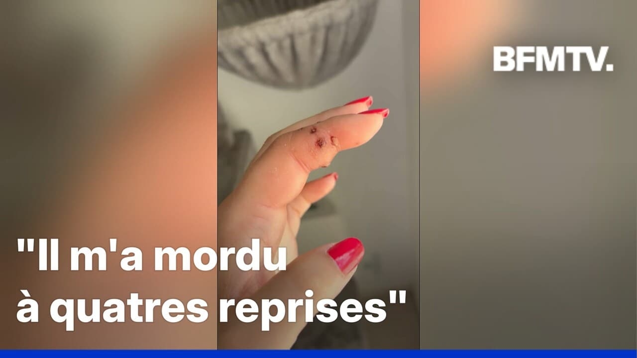 25,000 French people undergo surgery each year after a cat bite