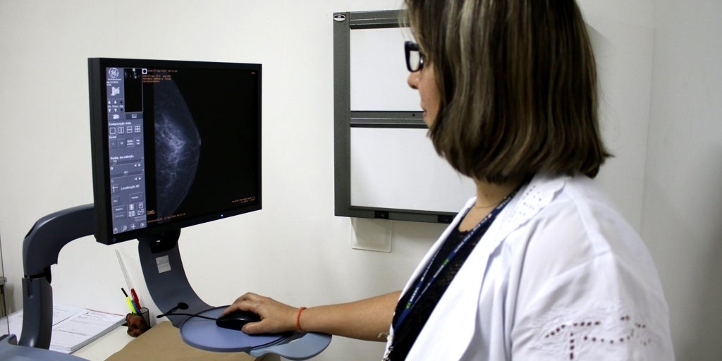 Yapay zeka, kötü prognozlu meme kanserine yakalanma riski yüksek olan kadınları tespit ediyor.