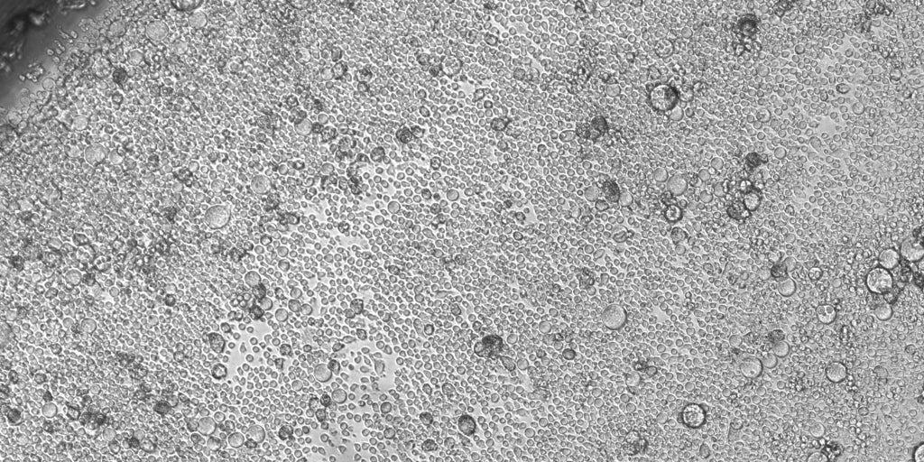 From the age of 50, some stem cells take control of the blood, causing it to lose diversity, and we are more prone to illness.