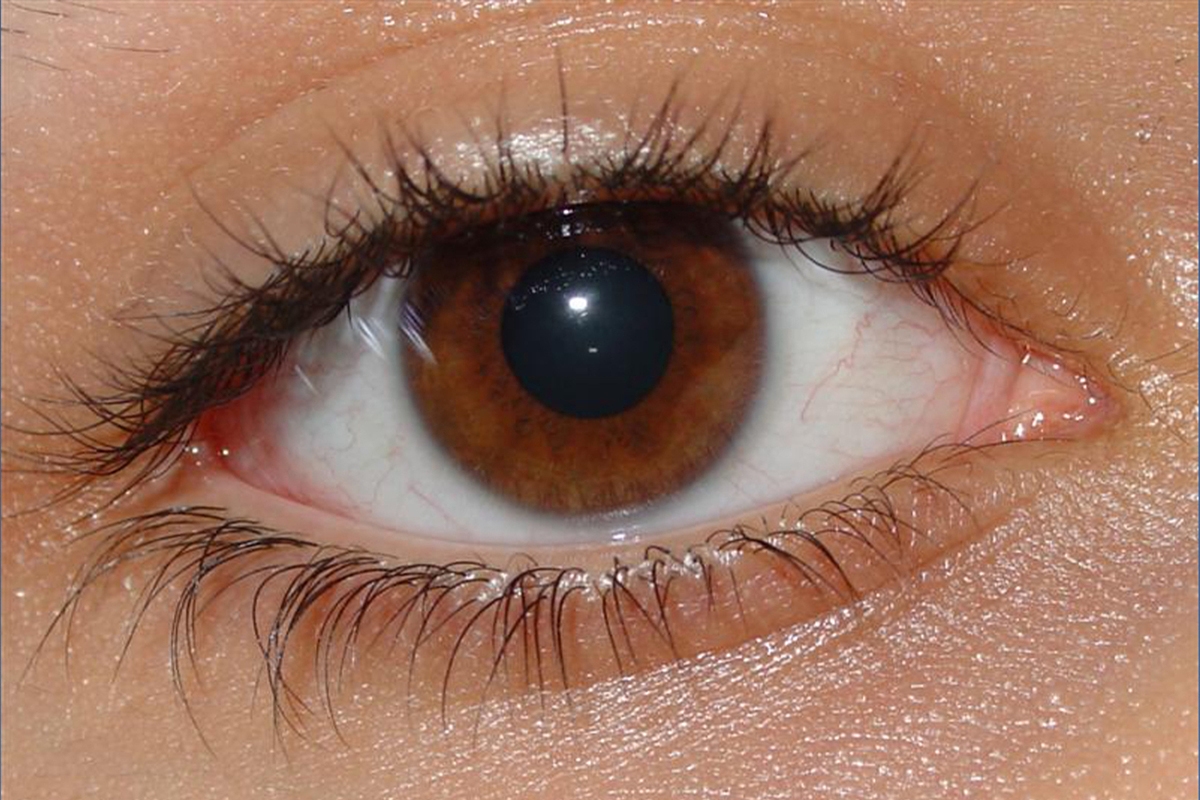 A inteligência artificial permitirá diagnosticar transtornos mentais usando a retina.