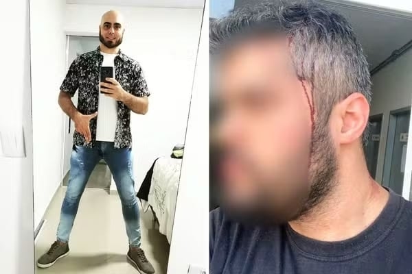 Bolsonaro'nun yeğeni kadın cinayetine teşebbüsten jürili yargılanacak.